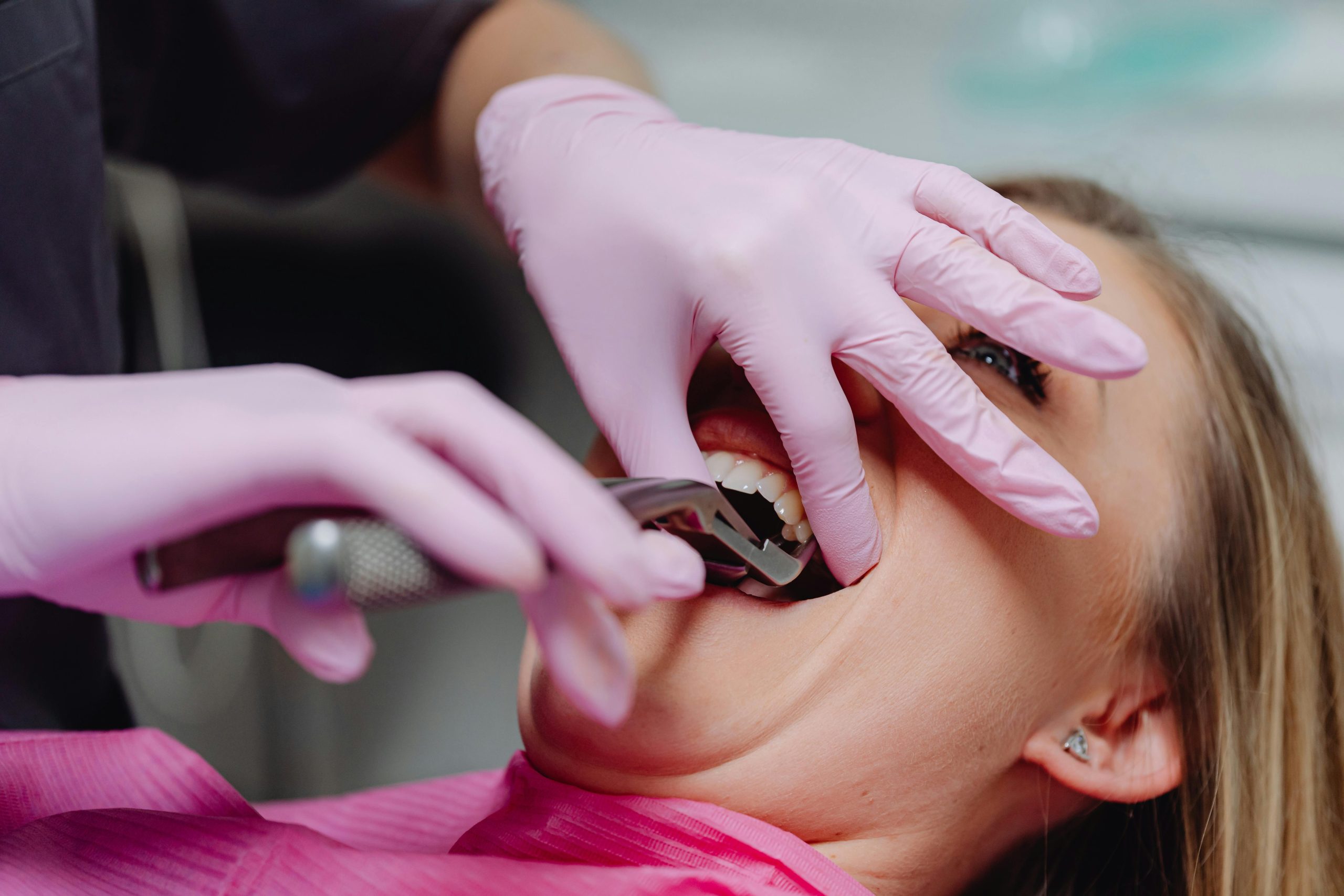 Wisdom Teeth Surgery